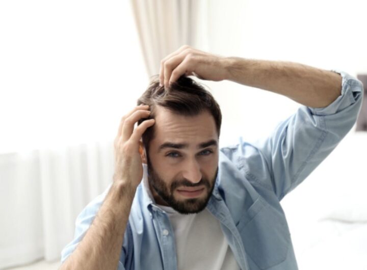 La caduta dei capelli è un fenomeno che spaventa molte persone, generando ansia